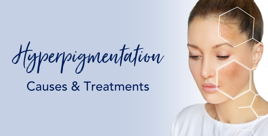 Hyperpigmentation Causes & Treatments